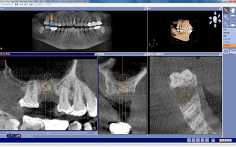 main_image